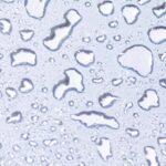 The Barrier Repair Set